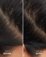 Anti-Dandruff Hair Shampoo